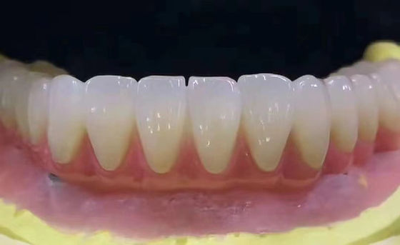 ซื้อ การปรับปรุงฟัน Zirconia รางวัลฟันทนทานคราบด้วยความแม่นยําสูง การผลิตออนไลน์