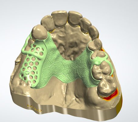 ซื้อ กรอบโลหะดิจิตอล CAD CAM การออกแบบฟัน Cocr วัสดุด้วยการพิมพ์ 3 มิติ การผลิตออนไลน์