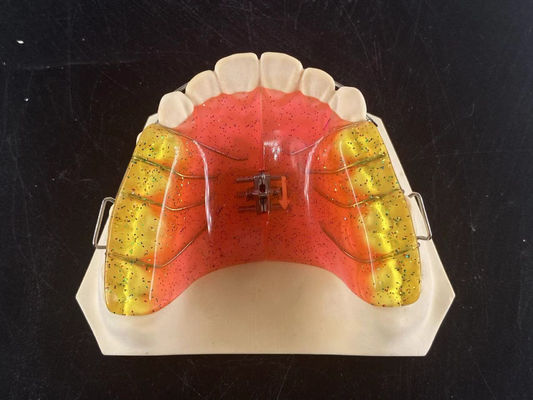 ซื้อ ปรับปรุง 2 ทาง การขยายขั้วฟัน ปรับปรุงอุปกรณ์ Orthodontic การผลิตออนไลน์