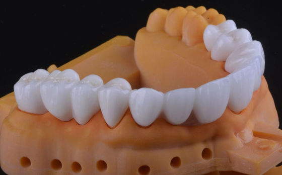 ความแข็งแรงสูง Zirconia รางวัลฟัน Ultra ทรานสเปรนกับระยะยาวคง