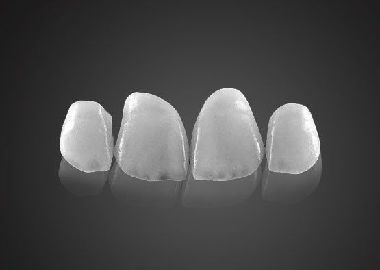 IPS 0.2mm Ultra Thin Emax Veneers ทนทานคราบ ด้วยความแข็งแรงสูง