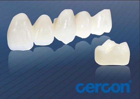 ทนทานการสกัด CAM Cercon Zirconia crowns ทําความสะอาดง่าย ความเข้ากันได้สูง
