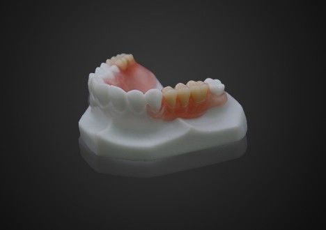 น้ําหนักเบา สะดวกสบาย Valplast แปลงฟันเทียมบางส่วน ทําความสะอาดง่าย ความโปร่งใสสูง