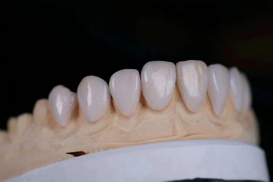 ความสวยงามสูง ราชกุฎห้องปฏิบัติการฟัน โปรเซลิน แผ่น Zirconia ทนต่อการทา