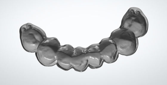 กระเป๋าไข่บด CAD CAM การออกแบบฟันสําหรับ PMMA